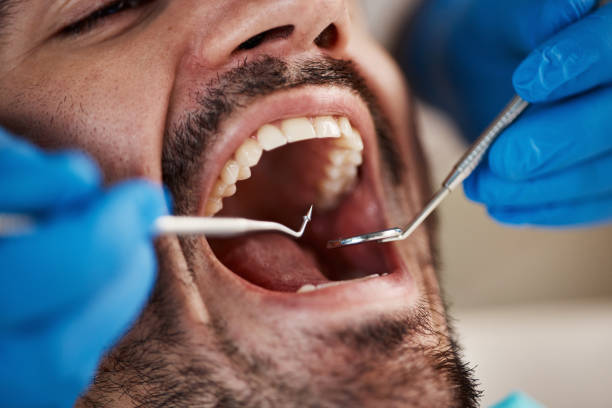 Best Emergency Treatment for Oral Infections in Stockbridge, GA